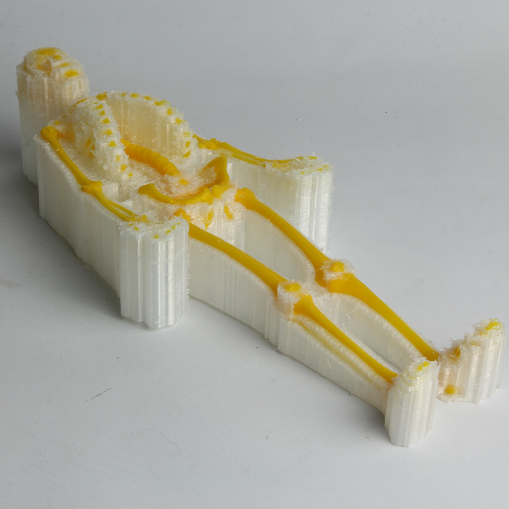 PolyDissolve™ S1